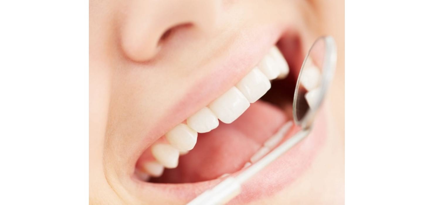 Parodontitis: Wenn der Zahn den Halt verliert